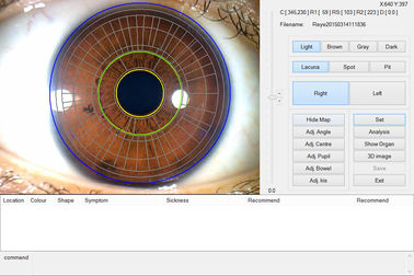 O analisador Handheld do varredor da íris do olho do CE portátil para a saúde detecta