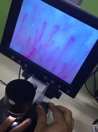 Microscópio do Microcirculation de Next Generation, microscópio do vaso sanguíneo para cuidados médicos