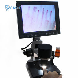 Ampliação médica do microscópio do Microcirculation capilar sobre 380 vezes