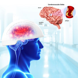 Comprimento de onda traumático dos dispositivos 810nm de Photobiomodulation do cérebro da lesão cerebral