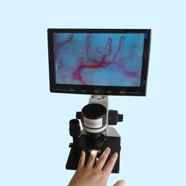 Microscópio do Microcirculation da cor da definição/equipamento altos diagnóstico do Microcirculation