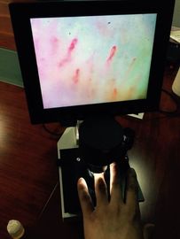 Microscópio aprovado do Microcirculation da cor do painel LCD do OEM do CE para a verificação do prego