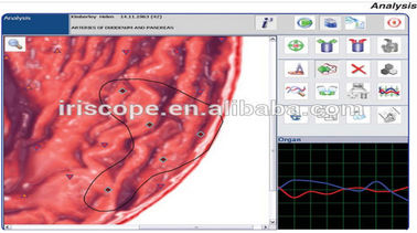 Caçador não-linear 4025 do sistema de Metatron NLS do equipamento da detecção para o analisador completo da saúde do corpo