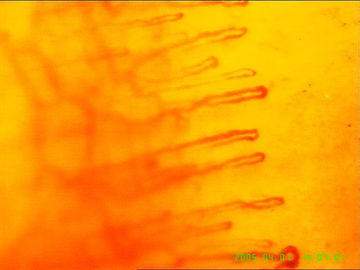 Microscópio capilar do sangue para detectar a saúde do corpo, garantia de 1 ano